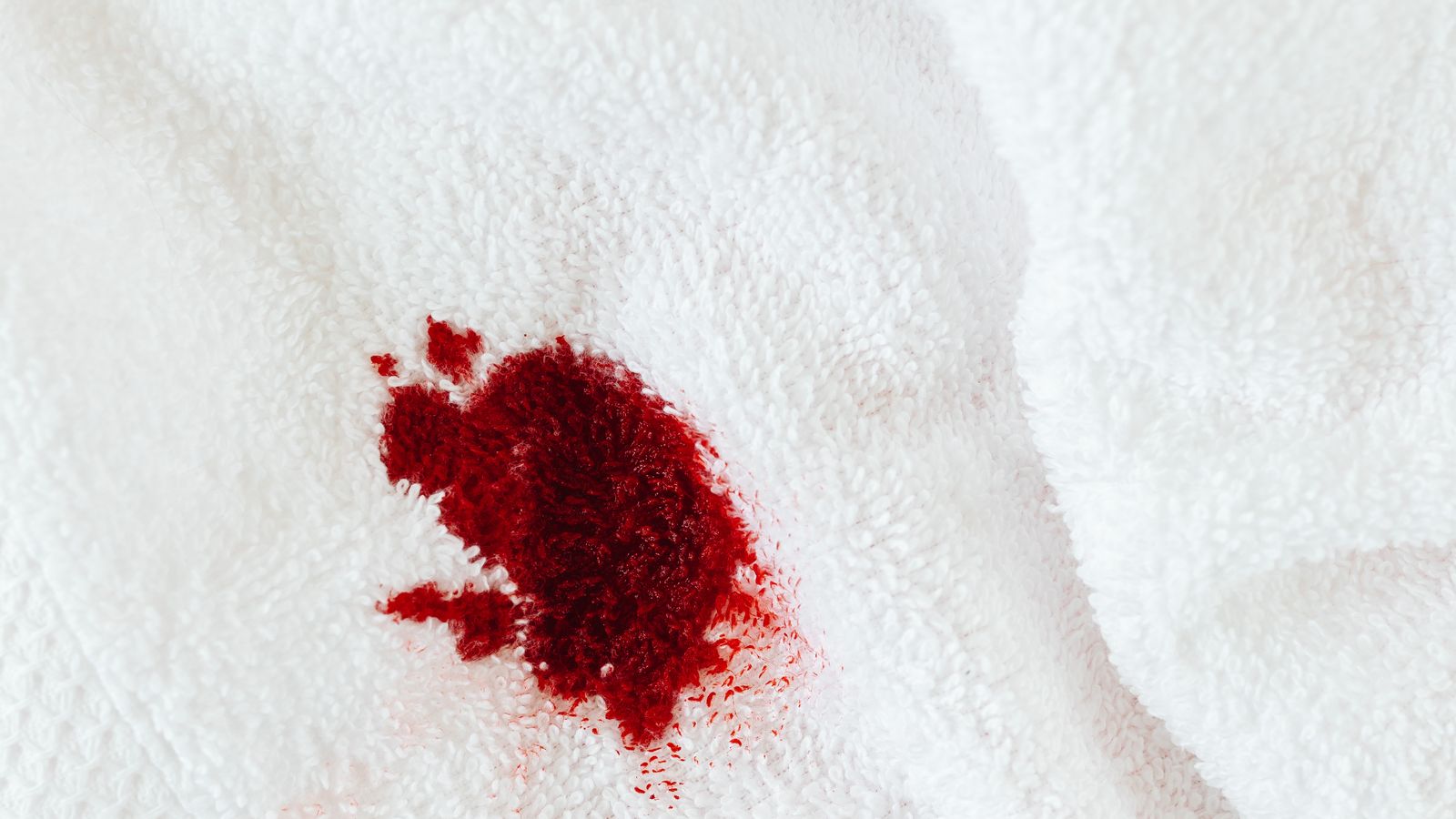 Person applying liquid stain remover directly onto a fabric stain before washing